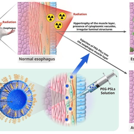 Mitigation of radiation-induced esophageal fibrosis by macrophage-targeted phosphatidylserine-containing liposomes with partial PEGylation