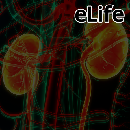 Uremic toxin indoxyl sulfate induces trained immunity via the AhR- dependent arachidonic acid pathway in end-stage renal disease (ESRD)