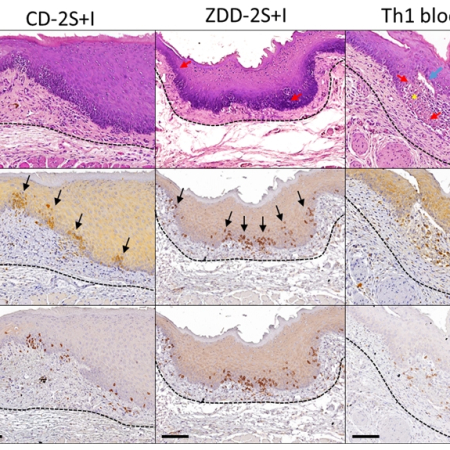 Induction of Oral Lichen Planus-Like Histopathology in Mice