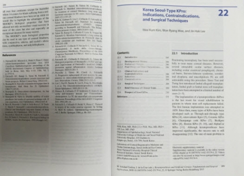 Keratoprostheses and Artificial Corneas, a famous US textbook on keratoprostheses